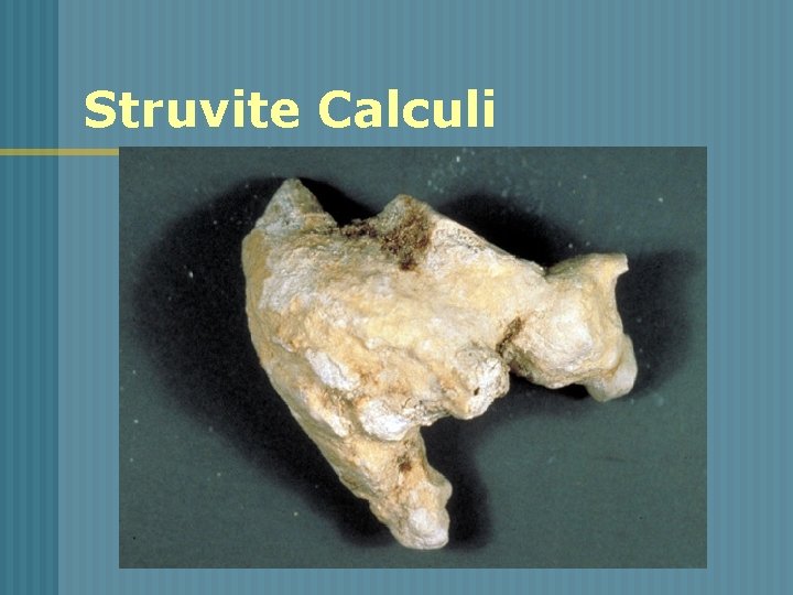 Struvite Calculi 