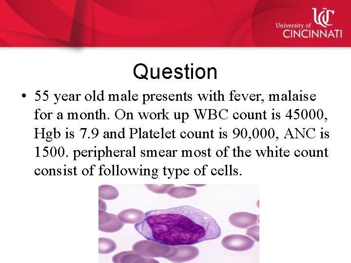 Question • 55 year old male presents with fever, malaise for a month. On