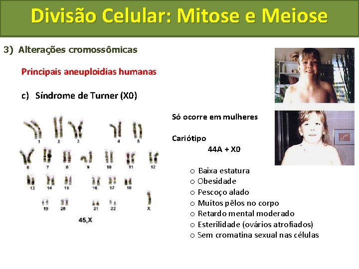 Divisão Celular: Mitose e Meiose 3) Alterações cromossômicas Principais aneuploidias humanas c) Síndrome de