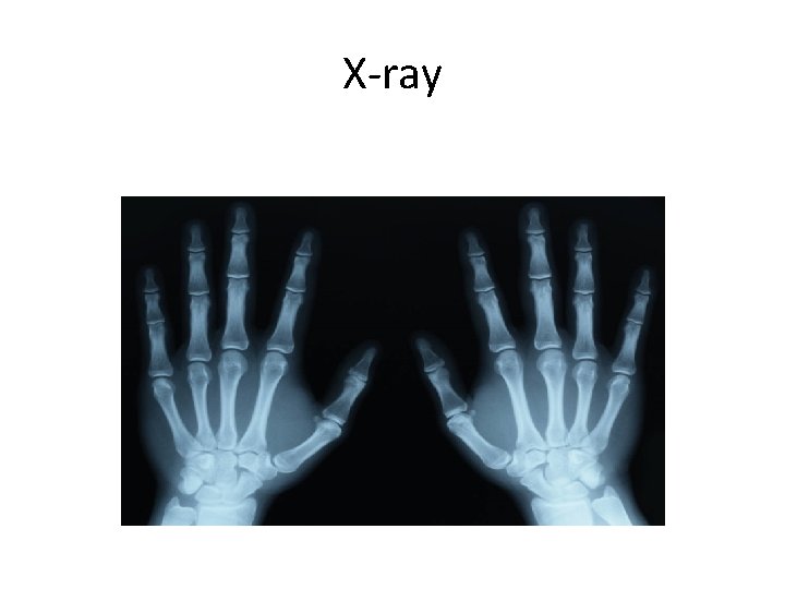 X-ray 