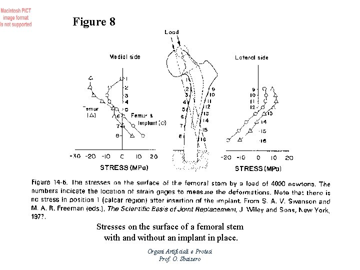 Figure 8 Stresses on the surface of a femoral stem with and without an