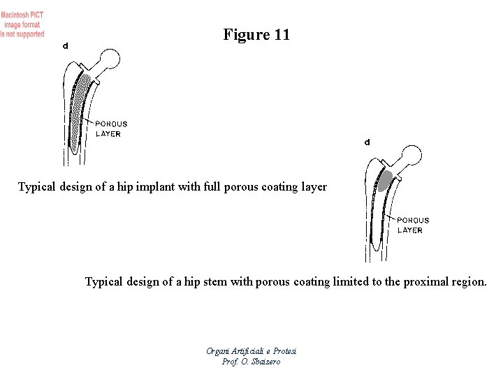 Figure 11 Typical design of a hip implant with full porous coating layer Typical