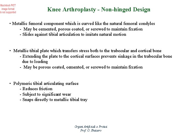 Knee Arthroplasty - Non-hinged Design • Metallic femoral component which is curved like the