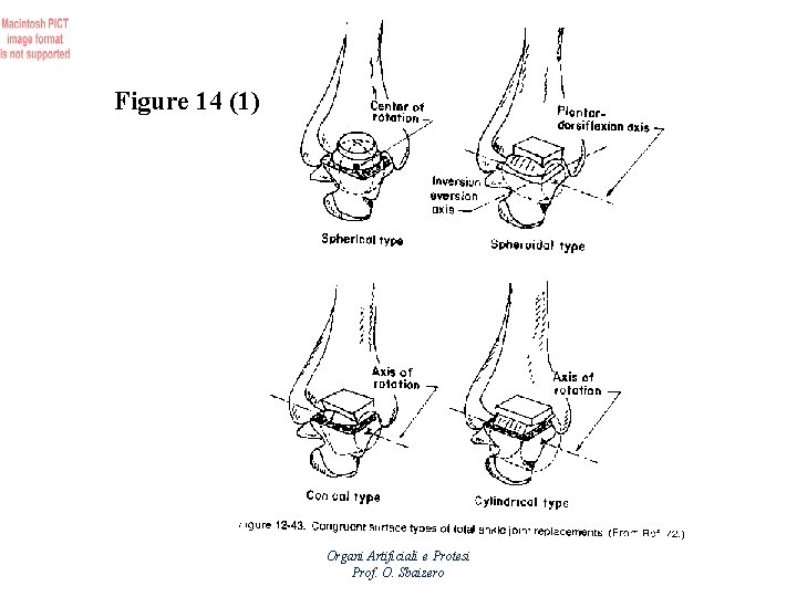 Figure 14 (1) Organi Artificiali e Protesi Prof. O. Sbaizero 