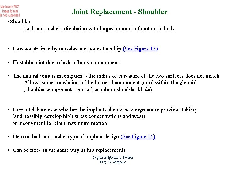 Joint Replacement - Shoulder • Shoulder - Ball-and-socket articulation with largest amount of motion