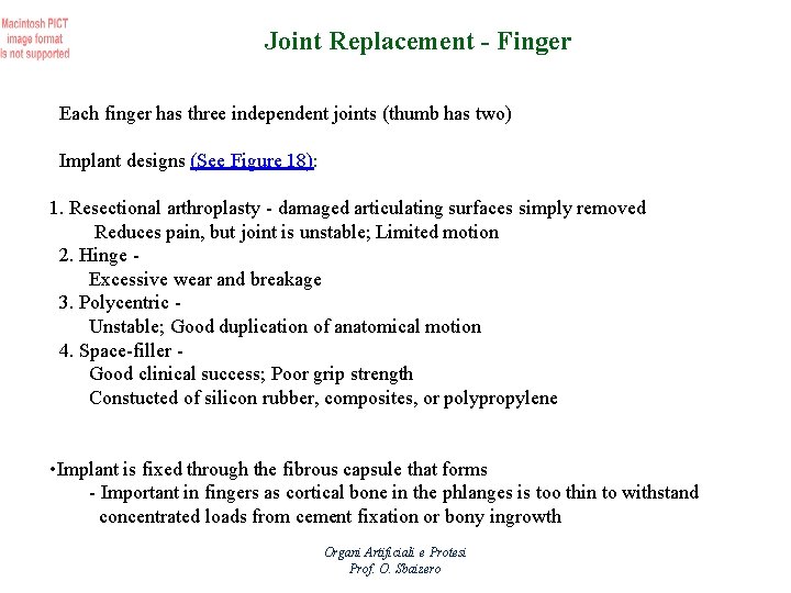 Joint Replacement - Finger Each finger has three independent joints (thumb has two) Implant