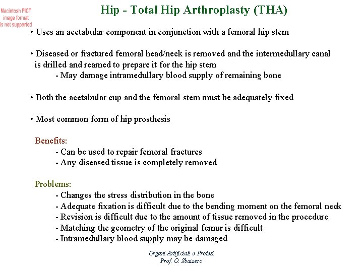 Hip - Total Hip Arthroplasty (THA) • Uses an acetabular component in conjunction with