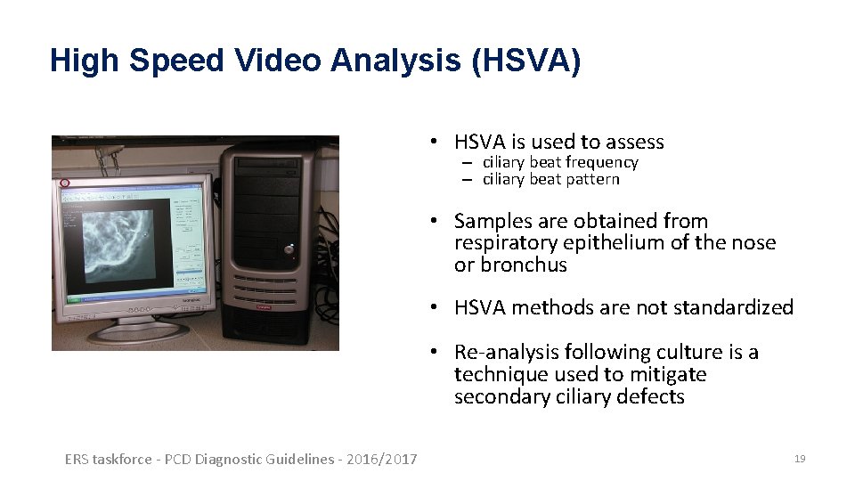 High Speed Video Analysis (HSVA) • HSVA is used to assess – ciliary beat High Speed Video Analysis (HSVA) • HSVA is used to assess – ciliary beat