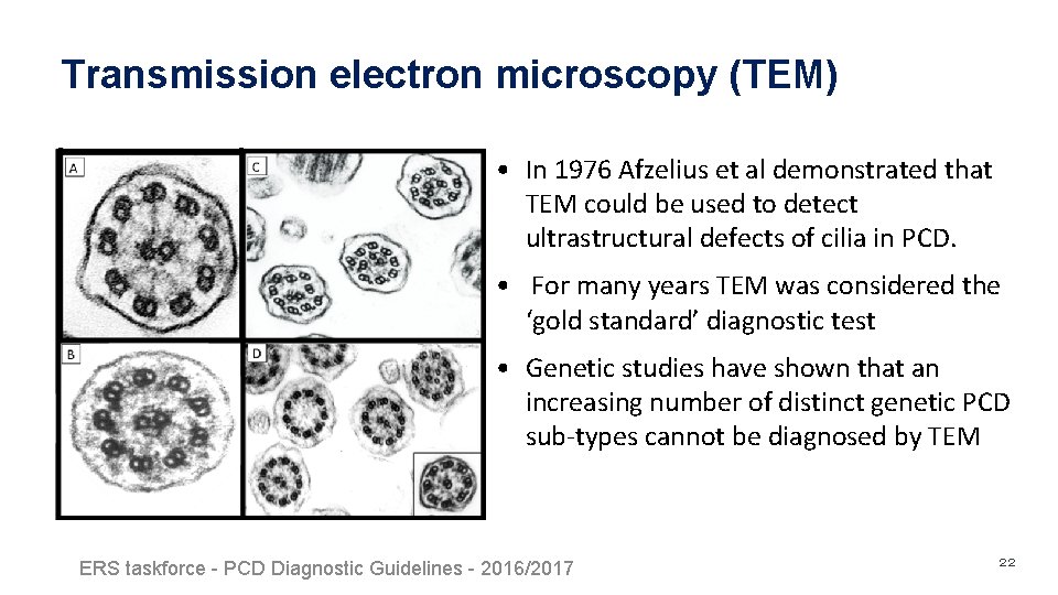 Transmission electron microscopy (TEM) • In 1976 Afzelius et al demonstrated that TEM could Transmission electron microscopy (TEM) • In 1976 Afzelius et al demonstrated that TEM could