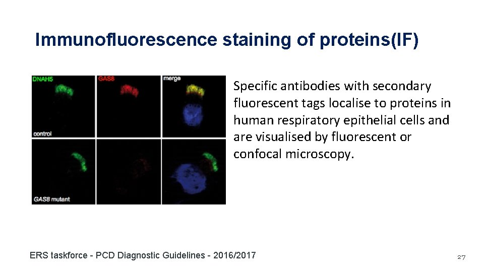 Immunofluorescence staining of proteins(IF) Specific antibodies with secondary fluorescent tags localise to proteins in Immunofluorescence staining of proteins(IF) Specific antibodies with secondary fluorescent tags localise to proteins in