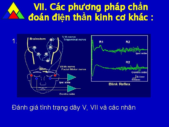 VII. Các phương pháp chẩn đoán điện thần kinh cơ khác : 1. Phản