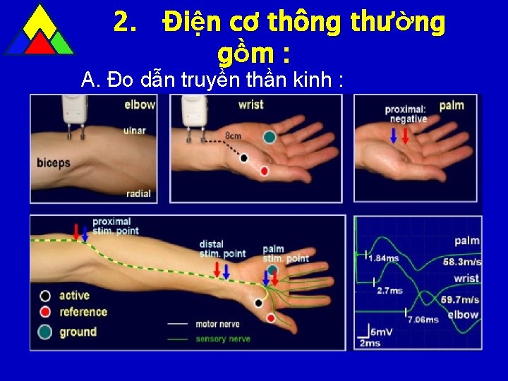 2. Điện cơ thông thường gồ m : A. Đo dẫn truyền thần kinh