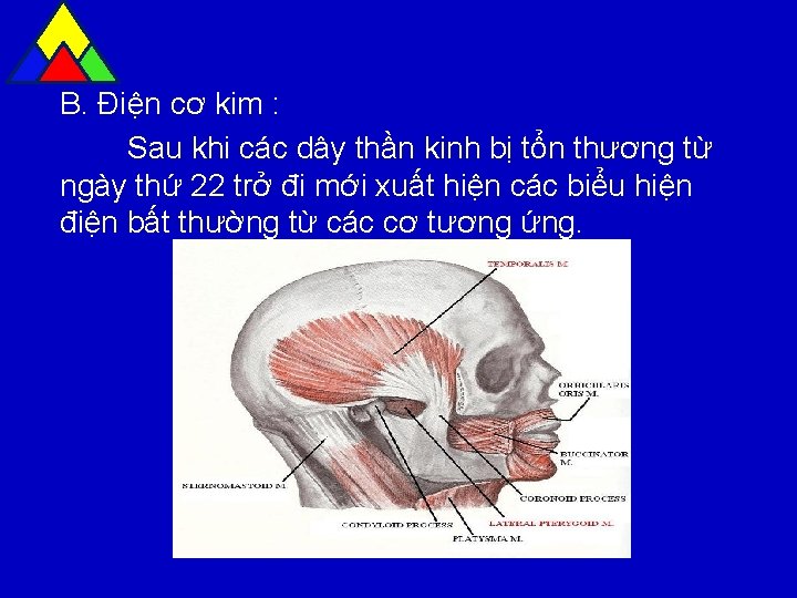 B. Điện cơ kim : Sau khi các dây thần kinh bị tổn thương