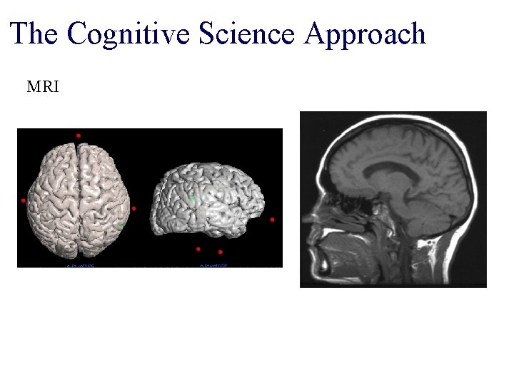 The Cognitive Science Approach MRI 