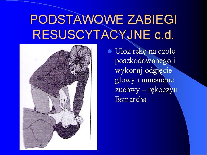 PODSTAWOWE ZABIEGI RESUSCYTACYJNE c. d. l Ułóż rękę na czole poszkodowanego i wykonaj odgięcie