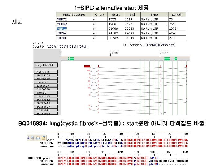 1 -SIPL: alternative start 제공 재원 BQ 016934: lung(cystic fibrosis-섬유증) : start뿐만 아니라 단백질도