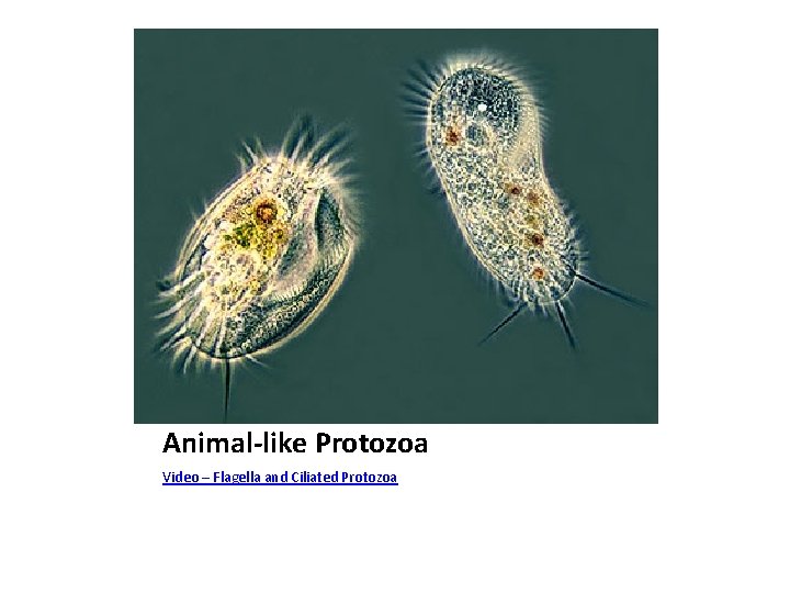Animal-like Protozoa Video – Flagella and Ciliated Protozoa 
