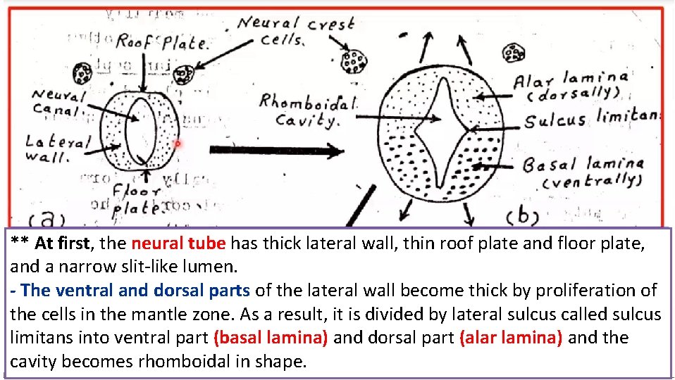 ** At first, the neural tube has thick lateral wall, thin roof plate and