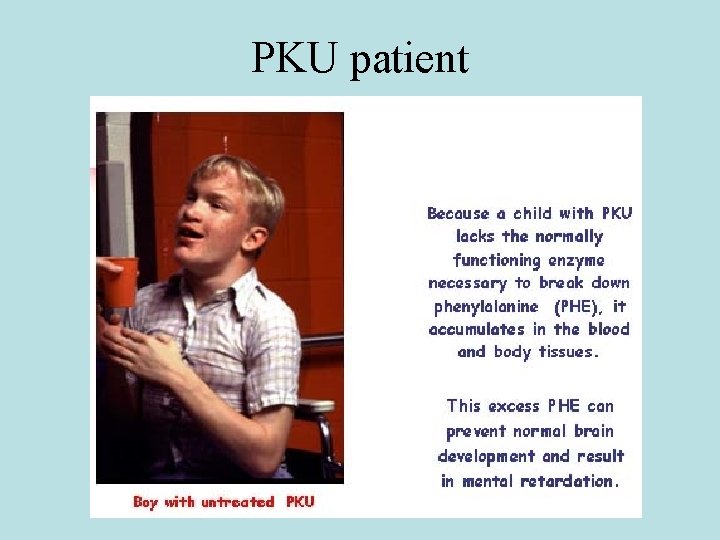 PKU patient 