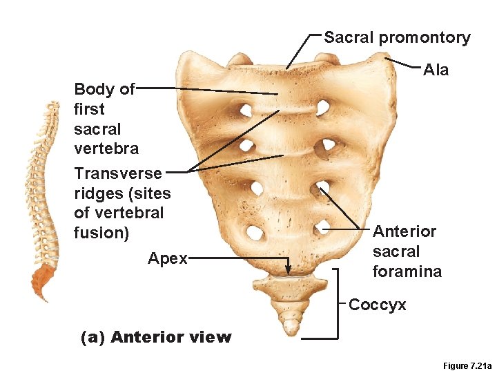 Sacral promontory Ala Body of first sacral vertebra Transverse ridges (sites of vertebral fusion)