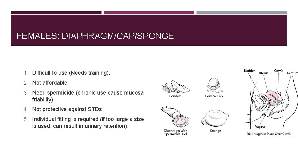 FEMALES: DIAPHRAGM/CAP/SPONGE 1. Difficult to use (Needs training). 2. Not affordable 3. Need spermicide