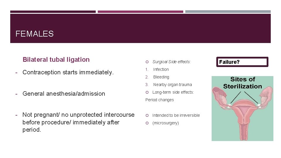 FEMALES Bilateral tubal ligation - Contraception starts immediately. - General anesthesia/admission Surgical Side effects: