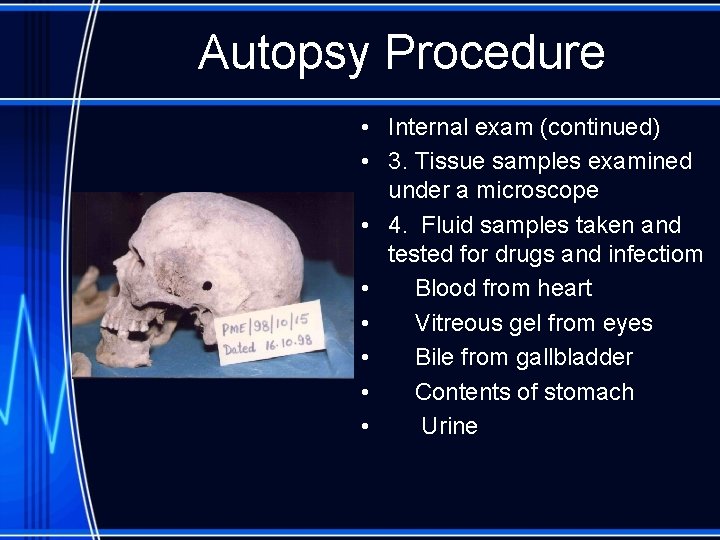 Autopsy Procedure • Internal exam (continued) • 3. Tissue samples examined under a microscope