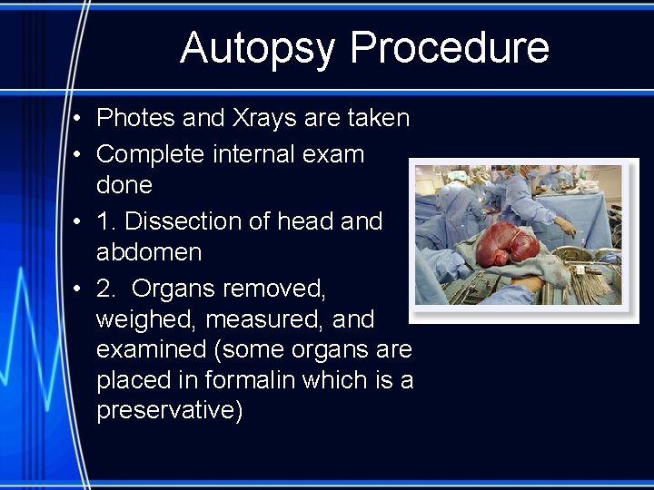 Autopsy Procedure • Photes and Xrays are taken • Complete internal exam done •