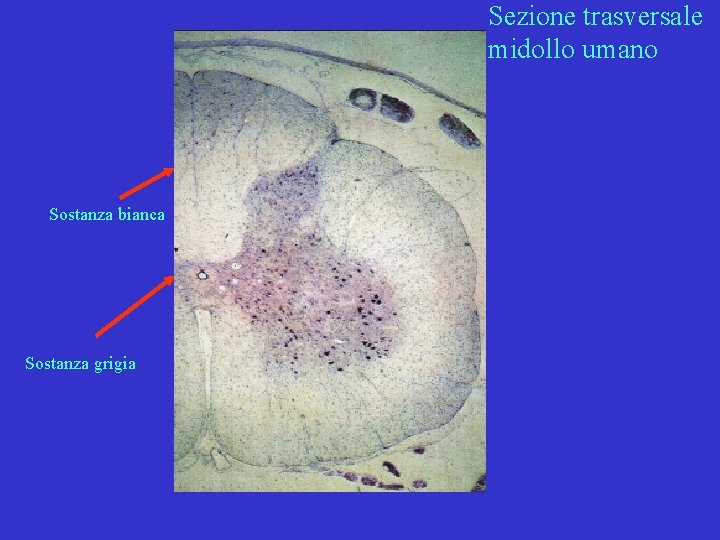 Sezione trasversale midollo umano Sostanza bianca Sostanza grigia 