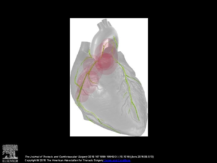 The Journal of Thoracic and Cardiovascular Surgery 2019 1571556 -1564 DOI: (10. 1016/j. jtcvs.