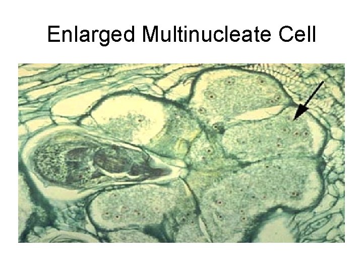 Enlarged Multinucleate Cell 