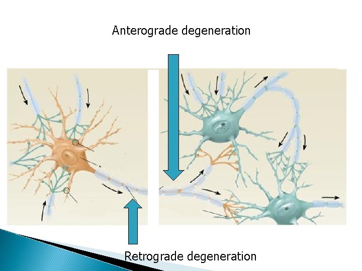 Anterograde degeneration Retrograde degeneration Anterograde degeneration Retrograde degeneration