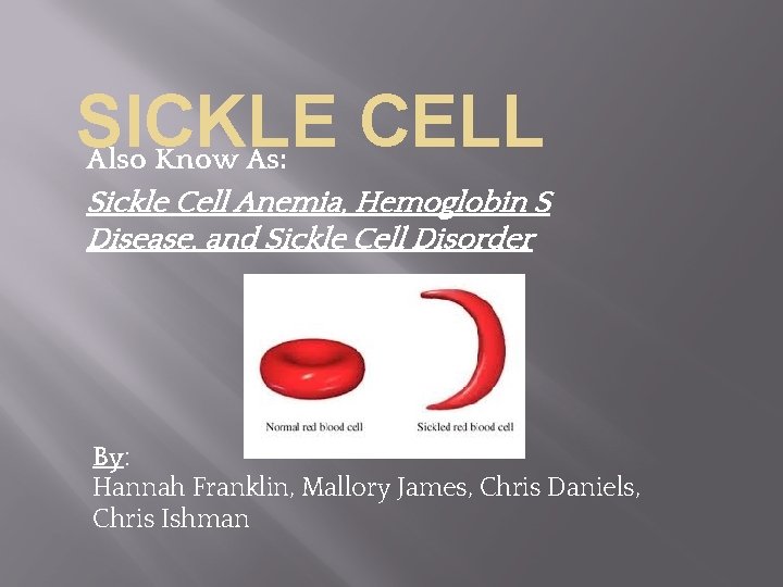 SICKLE CELL Also Know As: Sickle Cell Anemia, Hemoglobin S Disease, and Sickle Cell