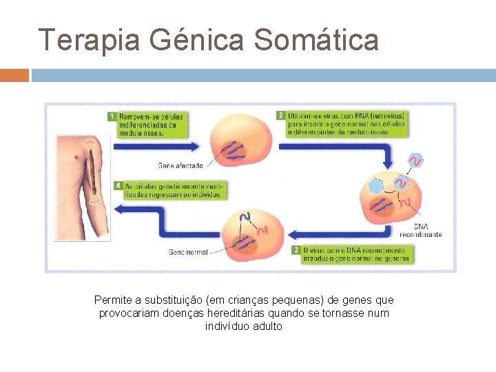 Terapia Génica Somática Permite a substituição (em crianças pequenas) de genes que provocariam doenças