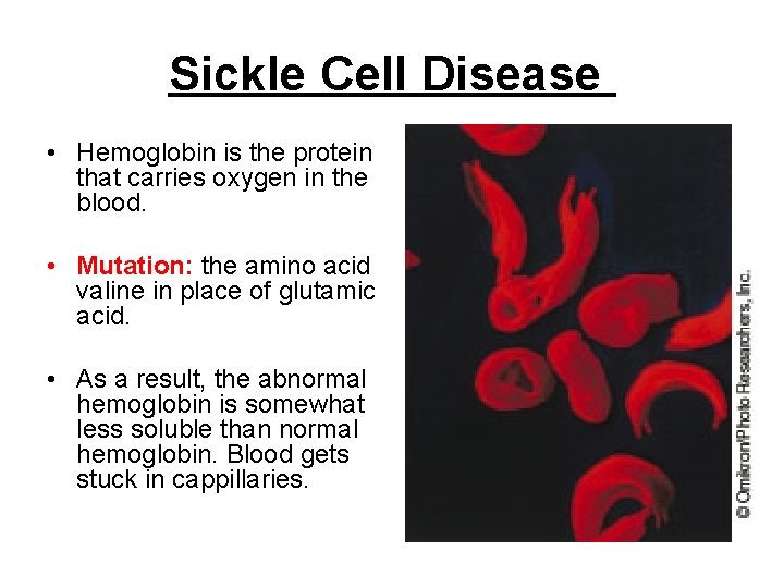 Sickle Cell Disease • Hemoglobin is the protein that carries oxygen in the blood.