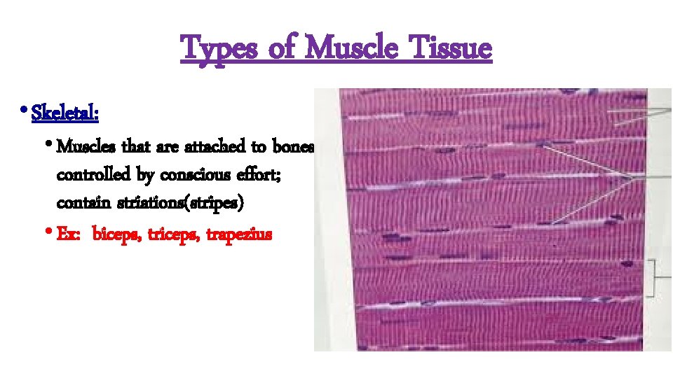 Types of Muscle Tissue • Skeletal: • Muscles that are attached to bones; controlled