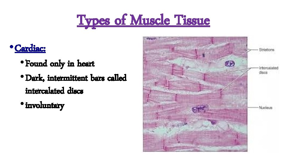 Types of Muscle Tissue • Cardiac: • Found only in heart • Dark, intermittent