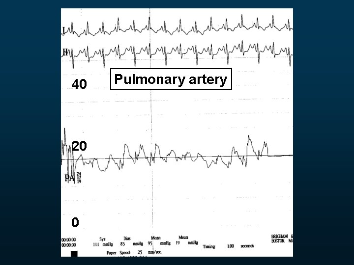 40 20 0 Pulmonary artery 