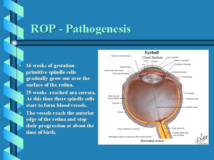 ROP - Pathogenesis Ø 16 weeks of gestation primitive spindle cells gradually grow out