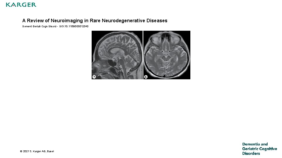 A Review of Neuroimaging in Rare Neurodegenerative Diseases Dement Geriatr Cogn Disord - DOI: