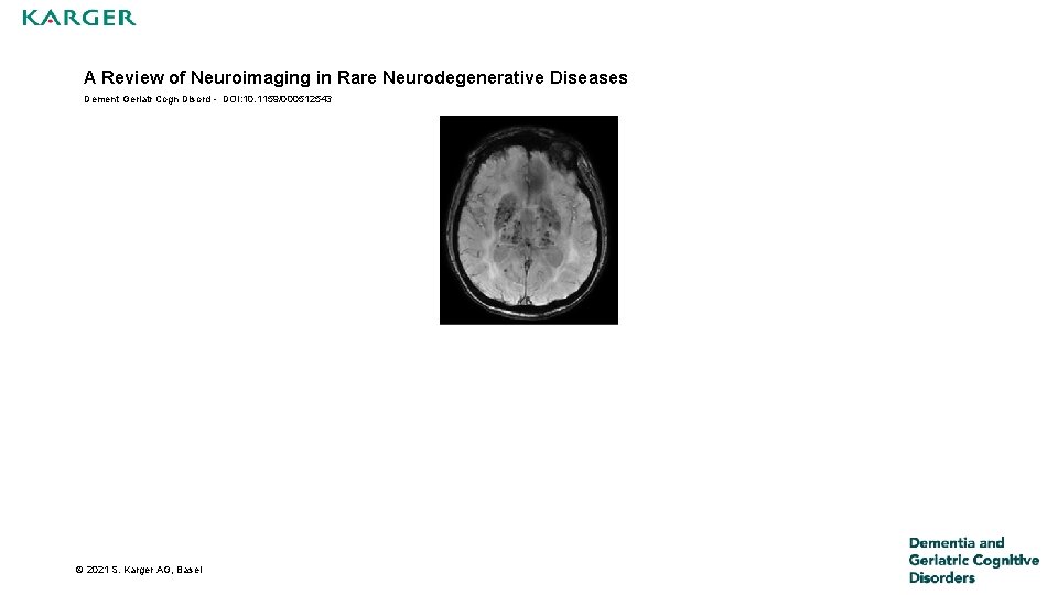 A Review of Neuroimaging in Rare Neurodegenerative Diseases Dement Geriatr Cogn Disord - DOI: