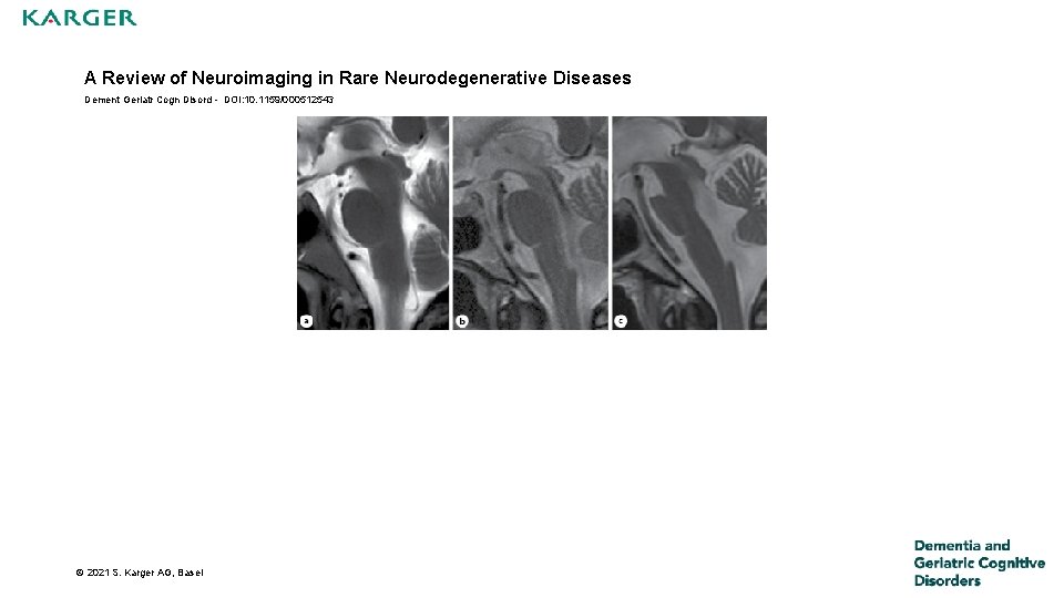 A Review of Neuroimaging in Rare Neurodegenerative Diseases Dement Geriatr Cogn Disord - DOI: