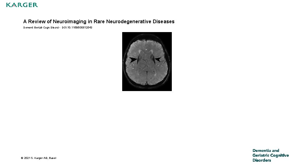 A Review of Neuroimaging in Rare Neurodegenerative Diseases Dement Geriatr Cogn Disord - DOI: