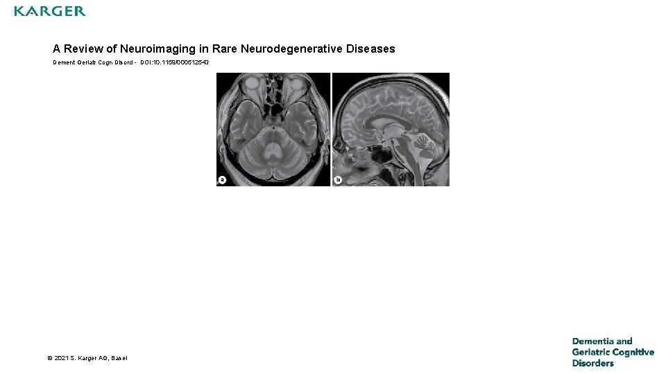 A Review of Neuroimaging in Rare Neurodegenerative Diseases Dement Geriatr Cogn Disord - DOI: