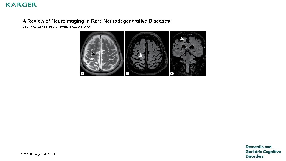 A Review of Neuroimaging in Rare Neurodegenerative Diseases Dement Geriatr Cogn Disord - DOI: