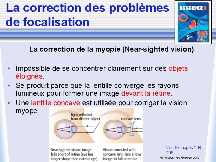 La correction des problèmes de focalisation La correction de la myopie (Near-sighted vision) •