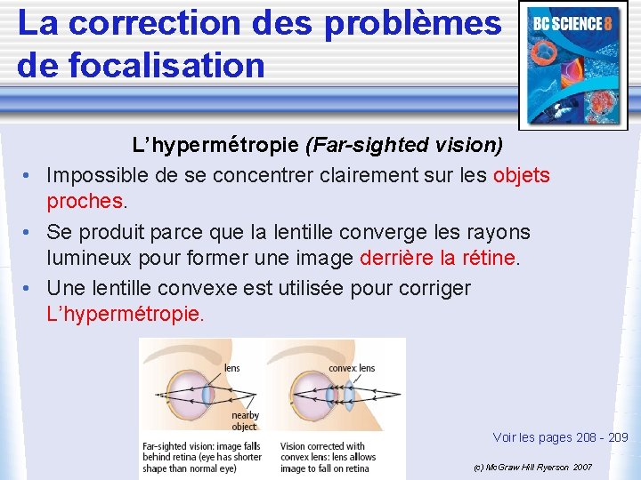 La correction des problèmes de focalisation L’hypermétropie (Far-sighted vision) • Impossible de se concentrer