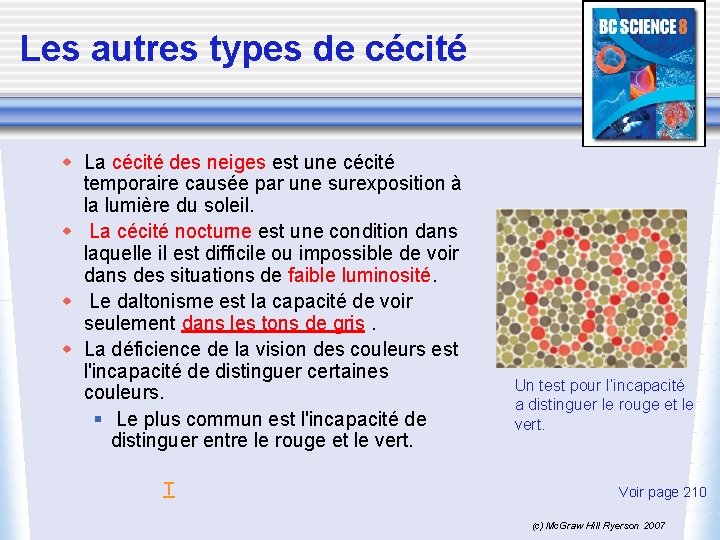 Les autres types de cécité w La cécité des neiges est une cécité temporaire