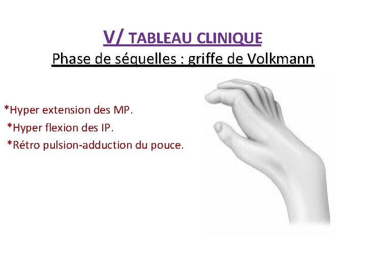 V/ TABLEAU CLINIQUE Phase de séquelles : griffe de Volkmann *Hyper extension des MP.