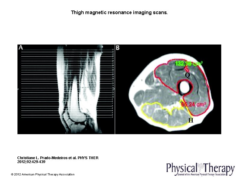 Thigh magnetic resonance imaging scans. Christiane L. Prado-Medeiros et al. PHYS THER 2012; 92: